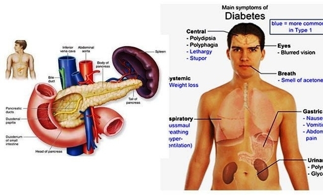 symptoms or signs of diabetes common