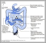 terminal ileum anatomy