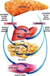 type diabetes mellitus symptoms causes