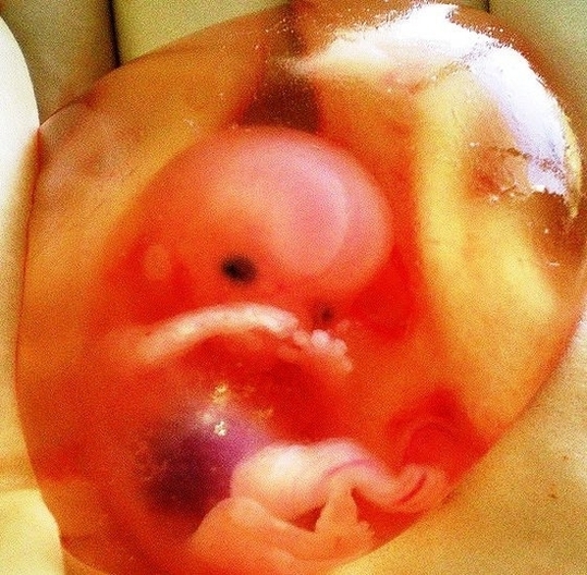 week fetal fetus