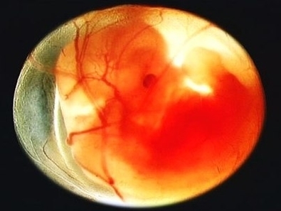 week human fetus in utero