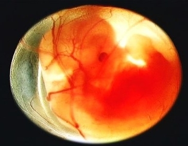 weeks human fetus in utero